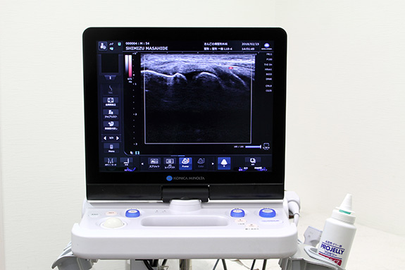 最新鋭のエコー検査